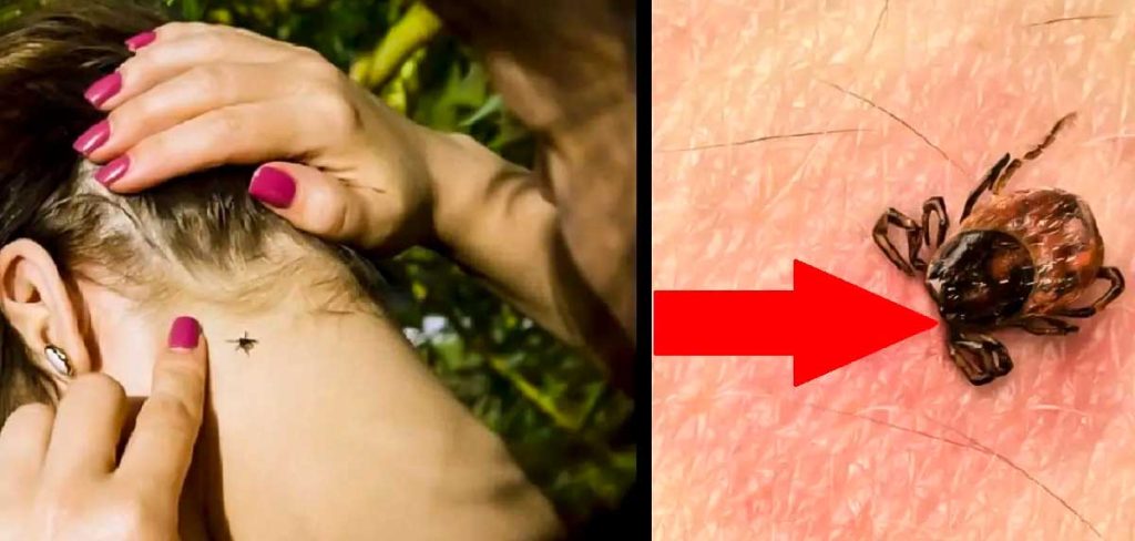 Cómo quitar una garrapata del cuerpo