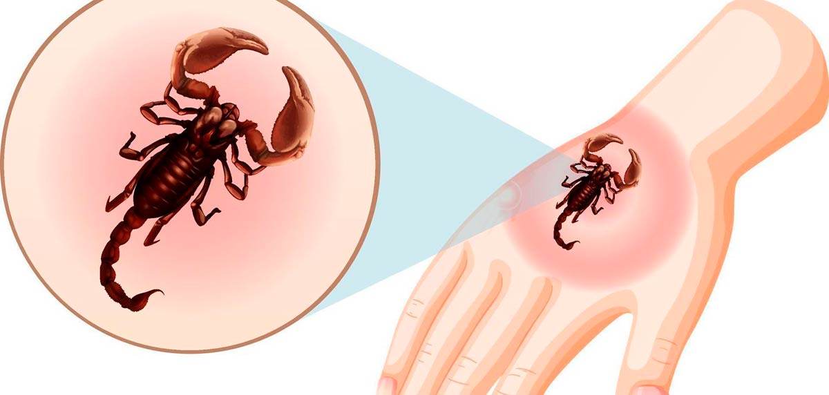 Síntomas de picadura de escorpión: todo lo que necesitas saber